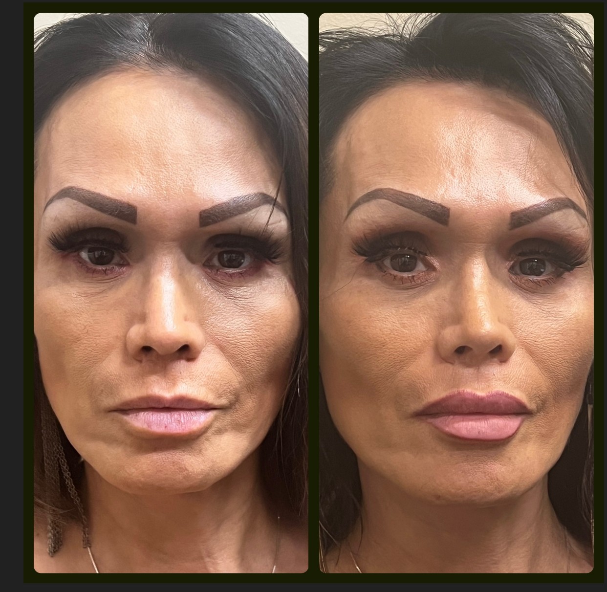 Surgical Before & After