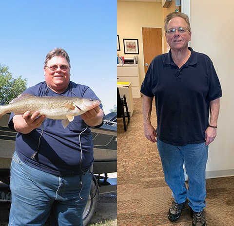 Orthopedic Patient Testimonials Dale Fritson before and after surgery