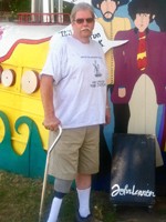 Lower Limb Amputation Success Stories Bill
