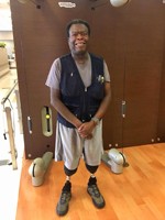 Lower Limb Amputation Success Stories Tony